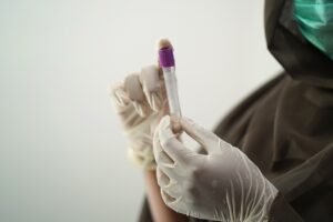 医療ダイエットにおける精神的ストレスの影響とは？